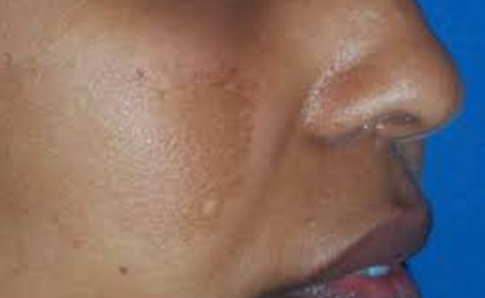 Skin whitening cream