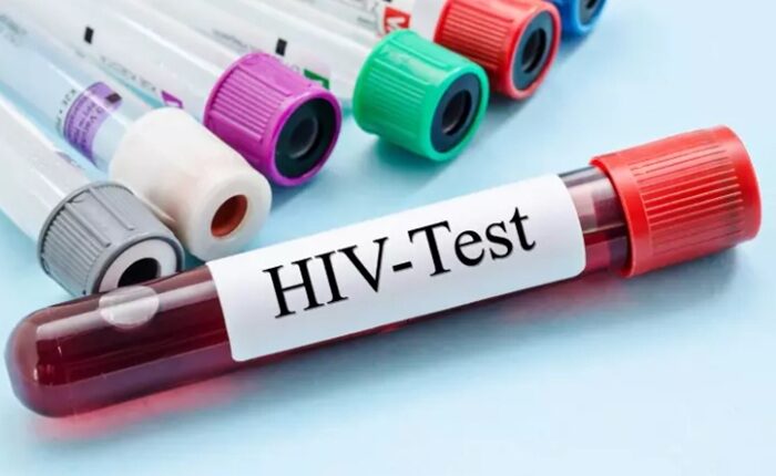 HIV test