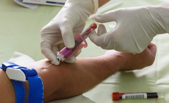 blood test