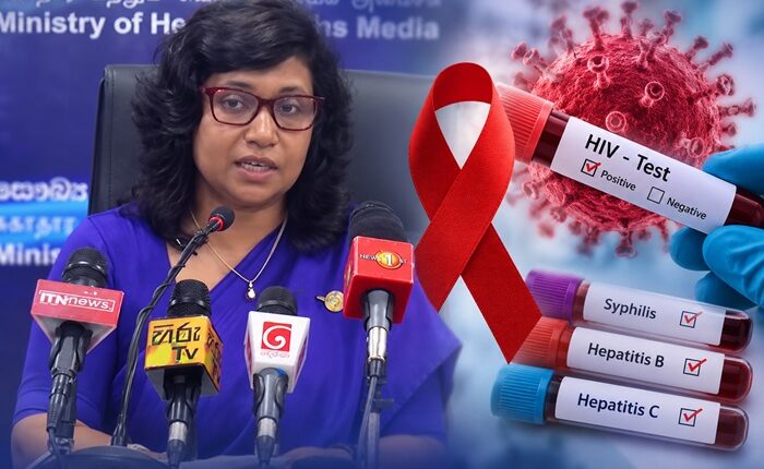 HIV SL
