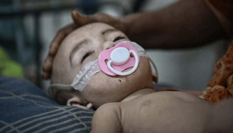 Measles outbreak